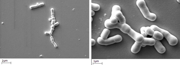 Бифидобактерии в жидких пробиотиках